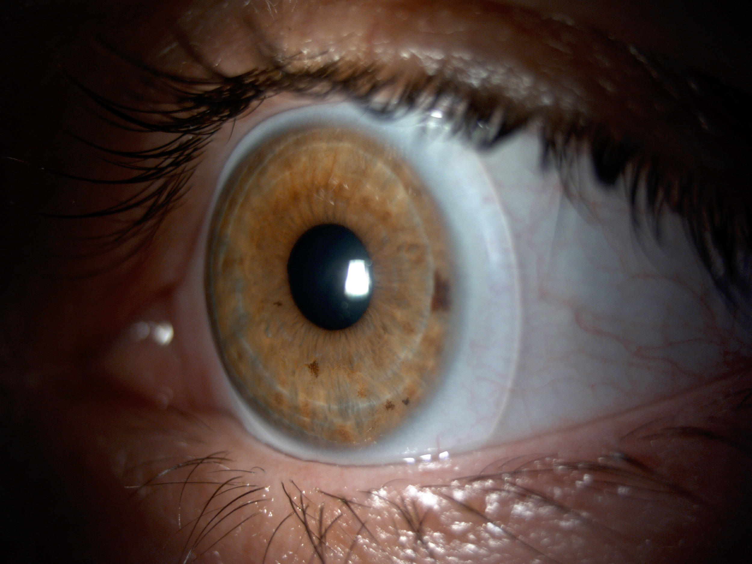 Close-up of a human brown eye with detailed iris, pupil, eyelashes, and surrounding eye tissue.