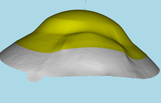 Eyeprintpro glaucoma