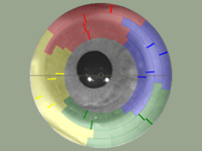 Close-up of an iris with colored markings in red, blue, green, yellow, and gray sections