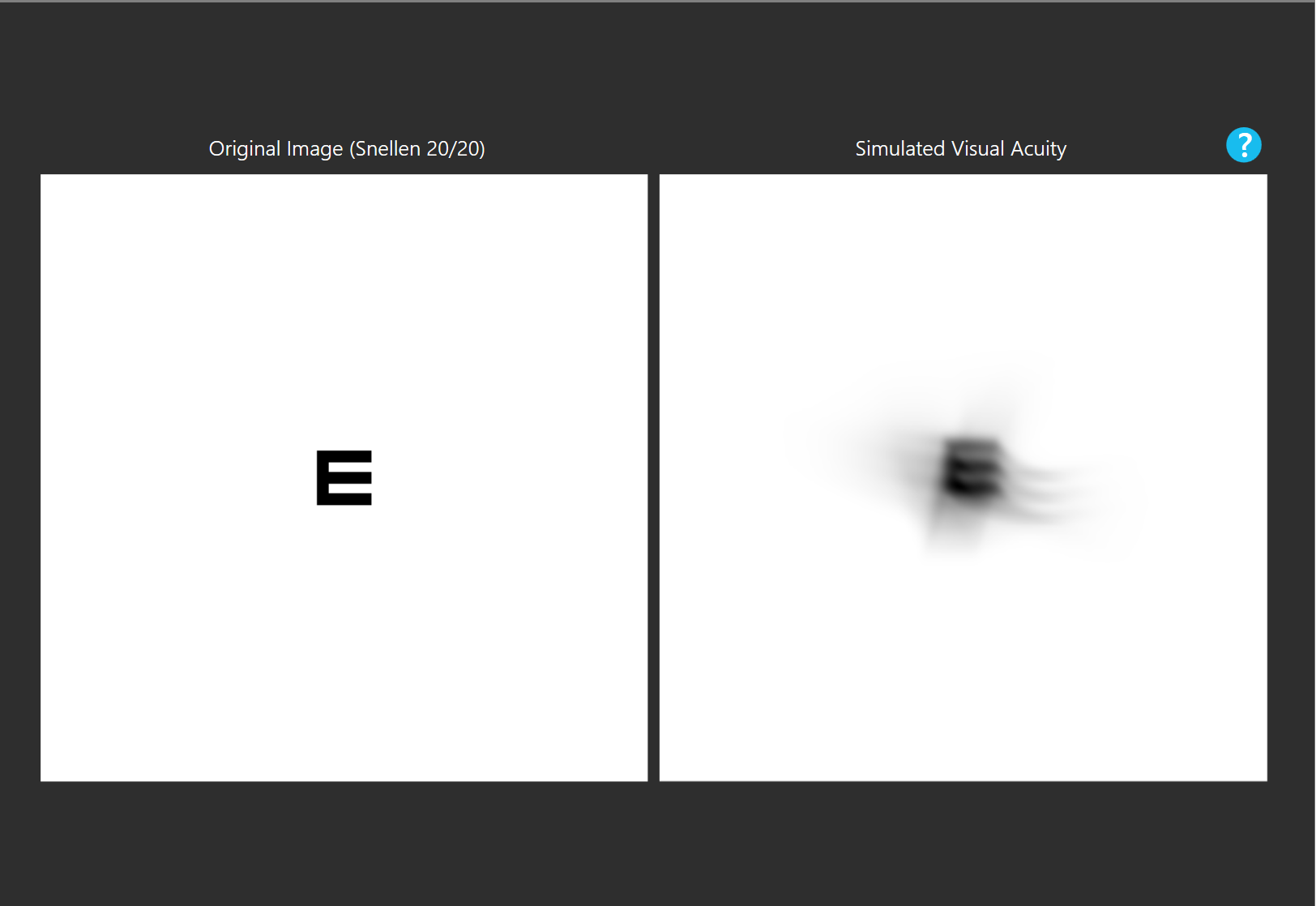 ovitz scleral lens astigmatism ghosting