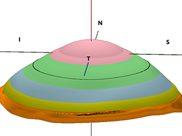 A three-dimensional topographic map with color-coded elevation levels, including pink, green, blue, yellow, and brown layers, with geographic orientation marked by 'N' for north and 'S' for south and a blue vertical line labeled 'T'.