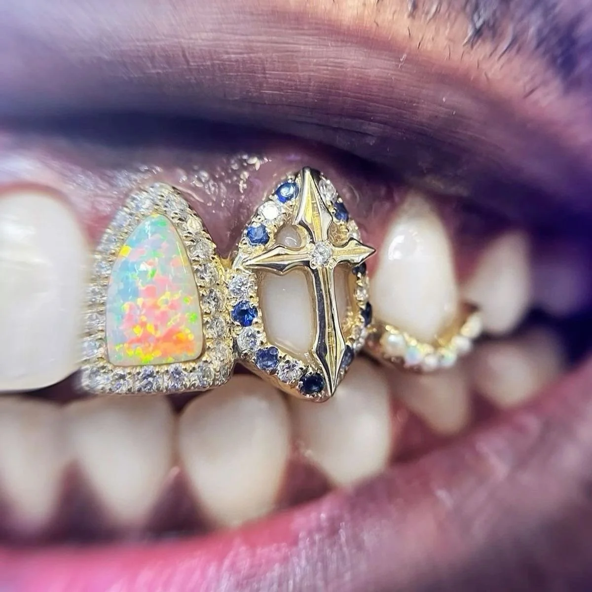 Forged Grillz