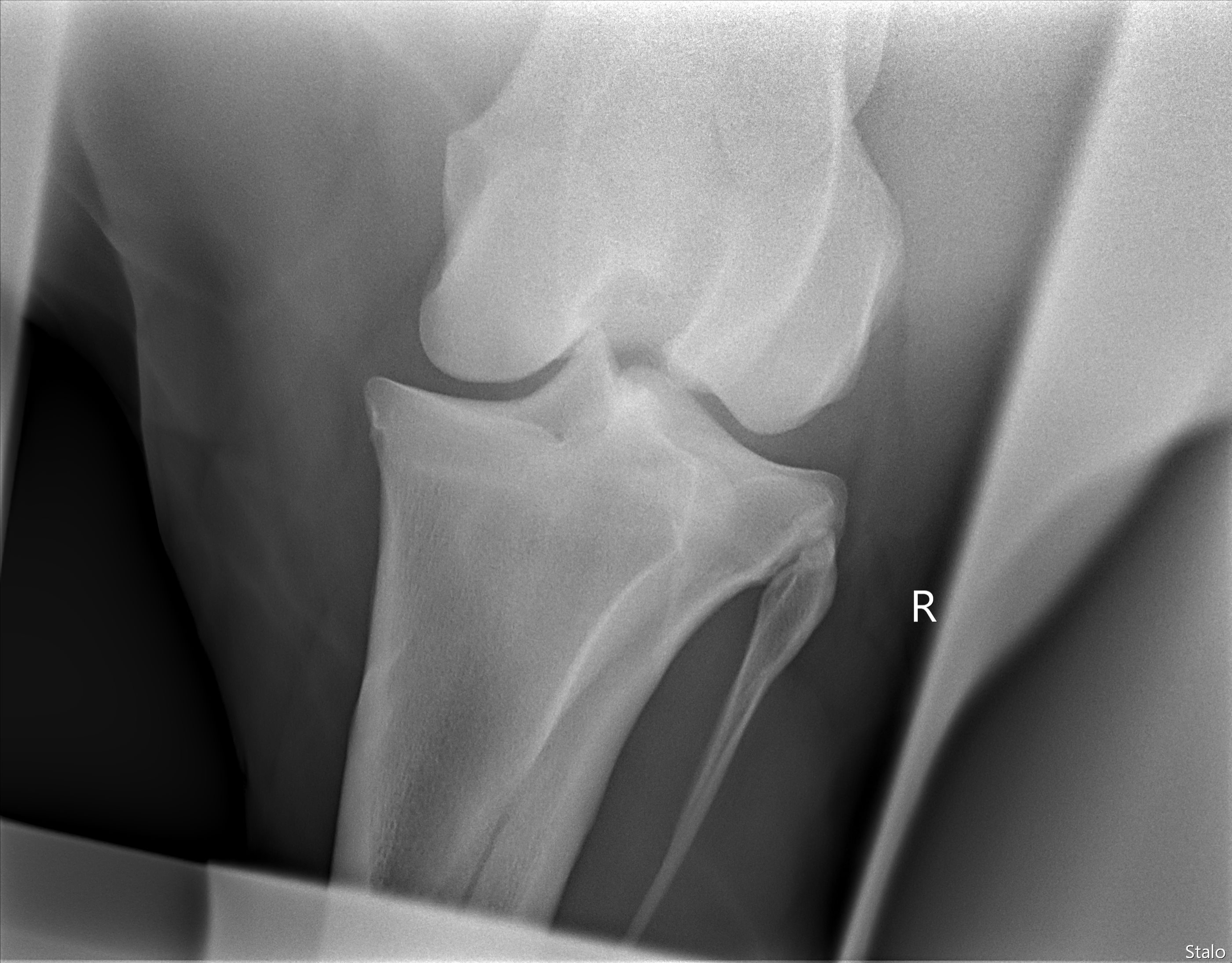 ALPHA ONE LAST GUN SMITH(22).png