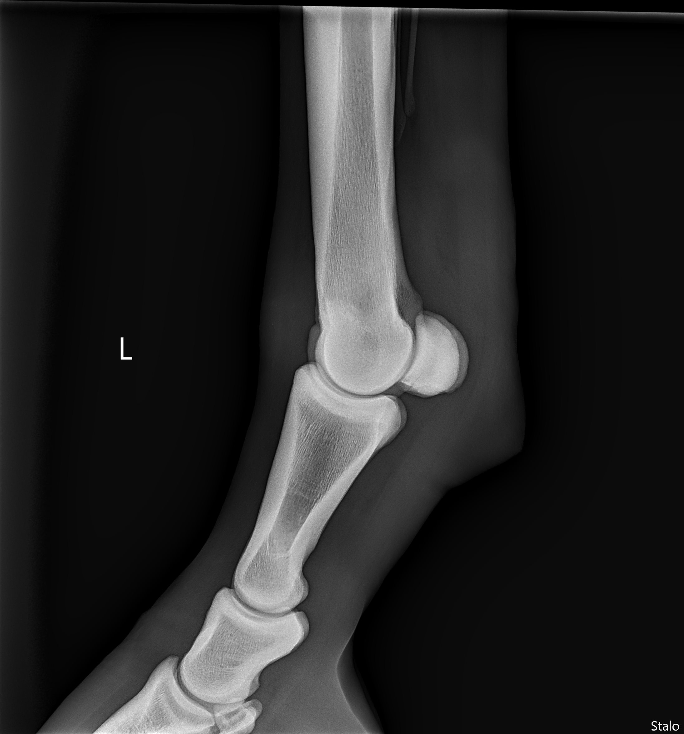 ALPHA ONE LAST GUN SMITH(15).png