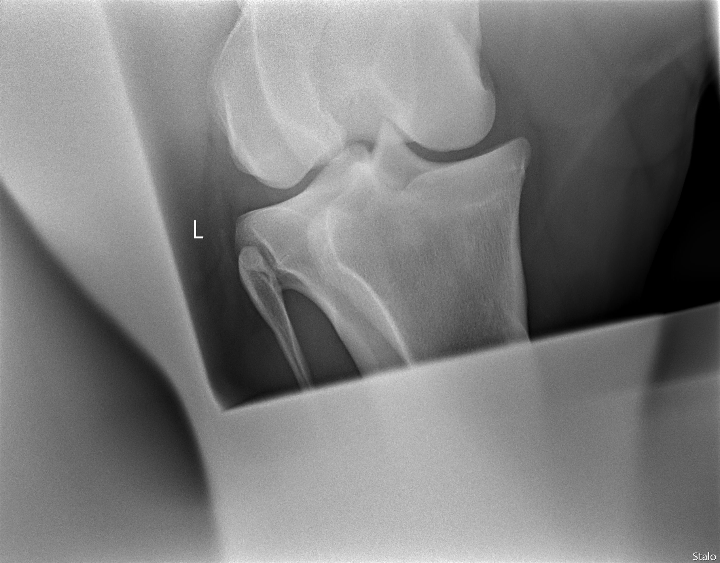 ALPHA ONE LAST GUN SMITH(20).png