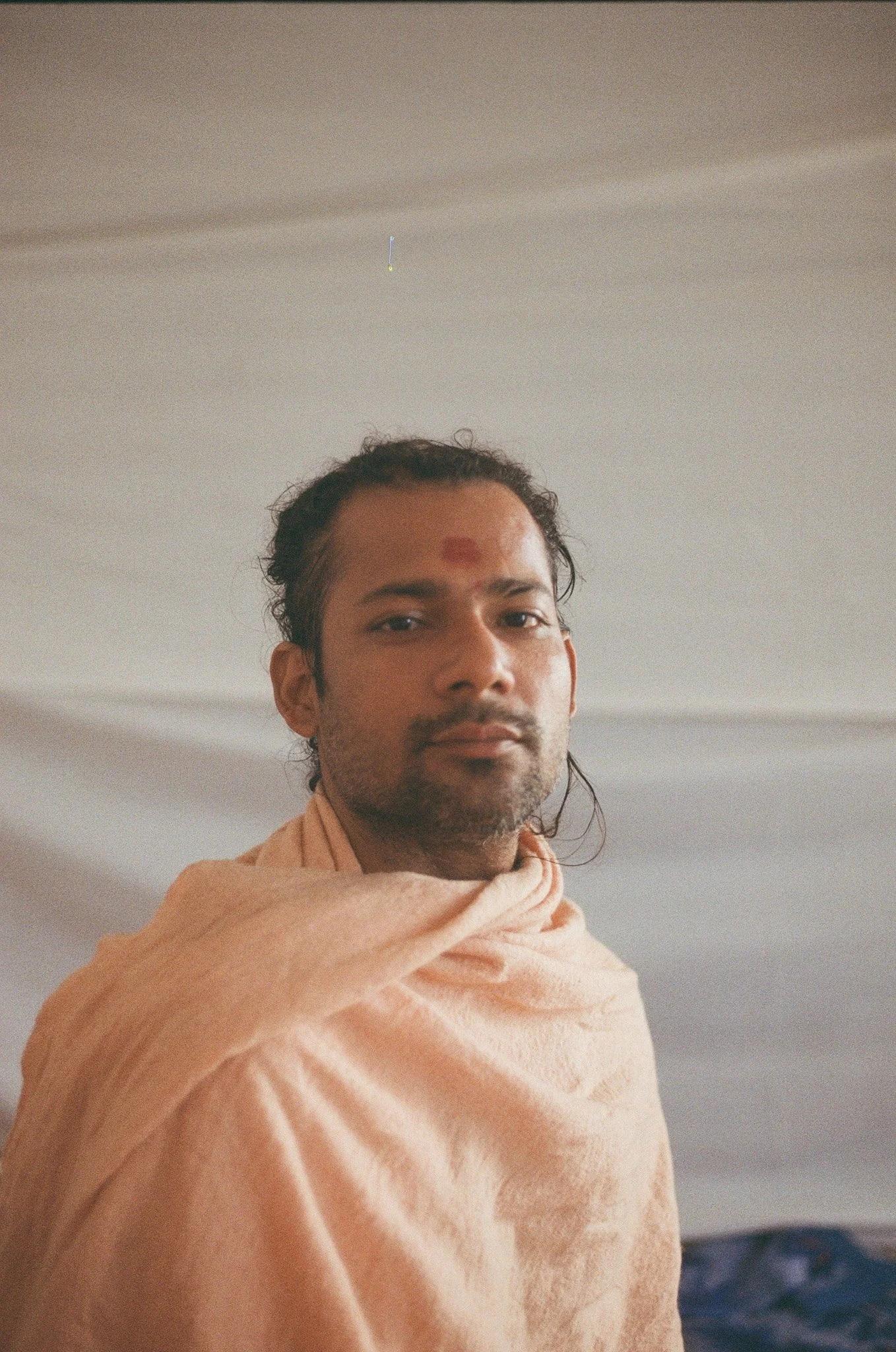 A man with a wound and bruising on his forehead, wrapped in a light-colored cloth, looking at the camera with a neutral expression against a plain background.