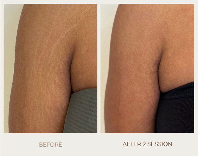 Screenshot 2025-12-01 012724.png