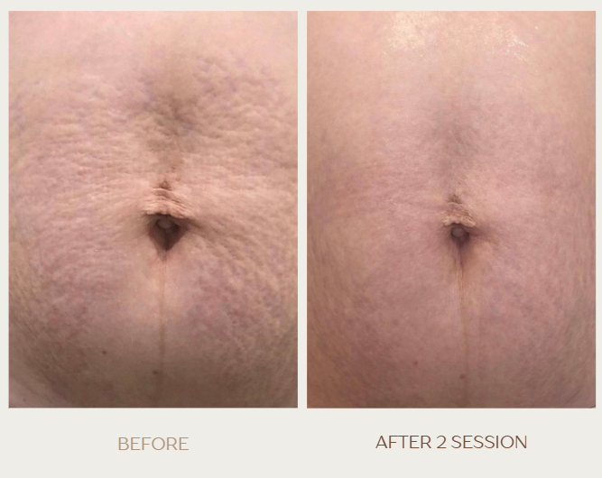 Screenshot 2025-12-01 012707.png