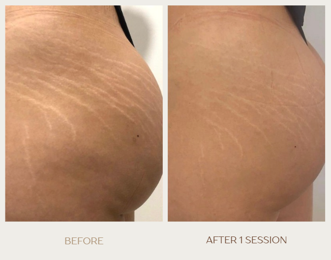 Screenshot 2025-12-01 012647.png