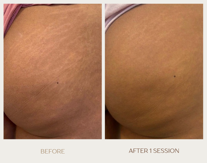 Screenshot 2025-12-01 012615.png