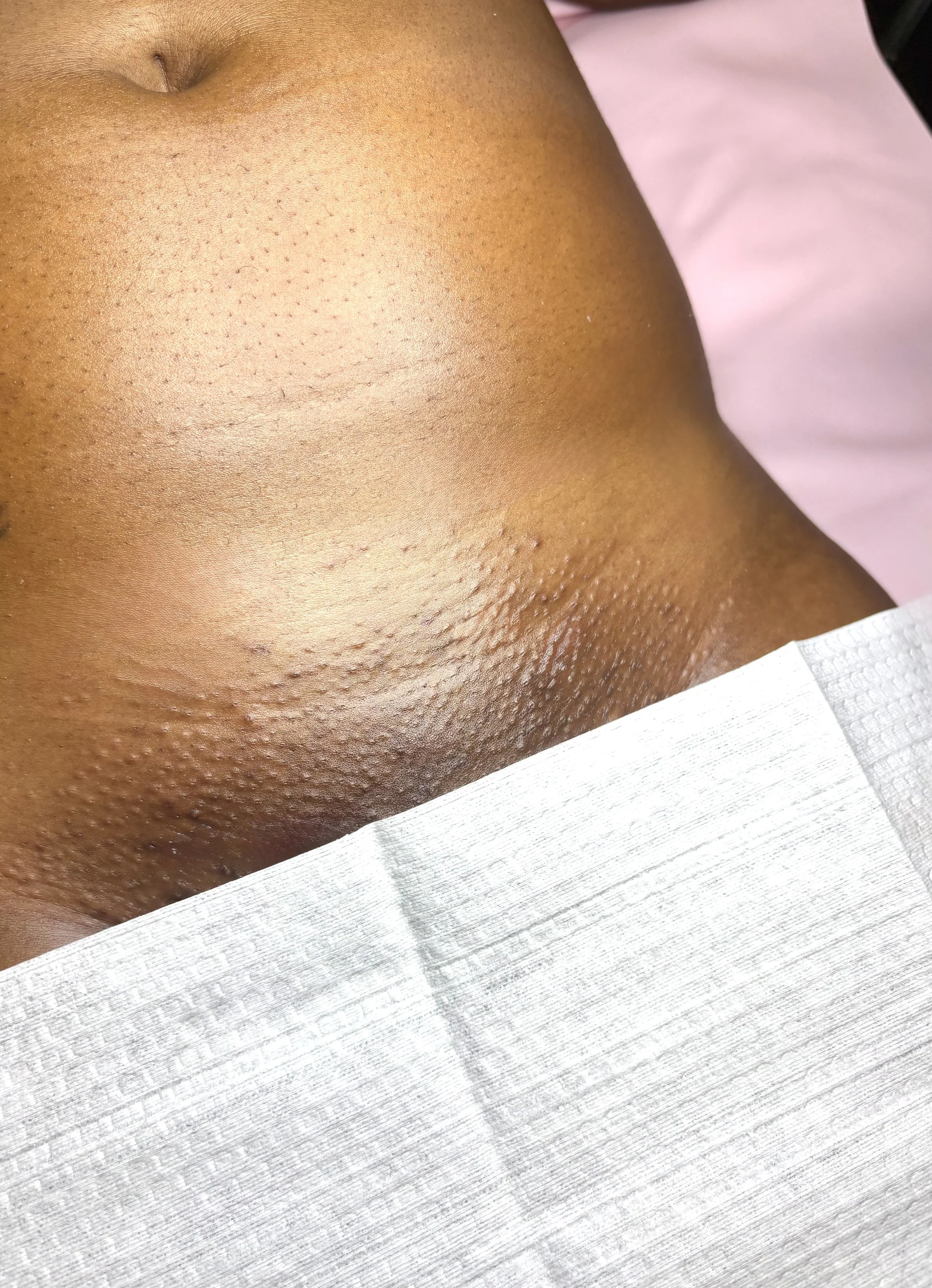 Laurel best brazilian laurel facials best waxer waxer near me skin lightening dark spots esthetician hyperpigmentation skincare cleanser glycolic lady peng aloe moisturizer