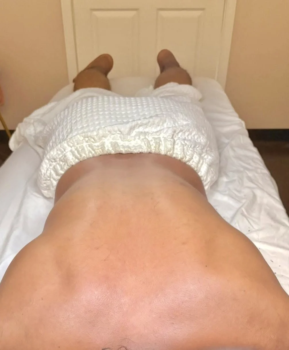 A person lying on a bed wearing a white disposable diaper, viewed from above.