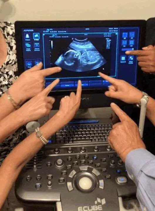 Group of people pointing at an ultrasound image on a medical monitor screen during a scan.