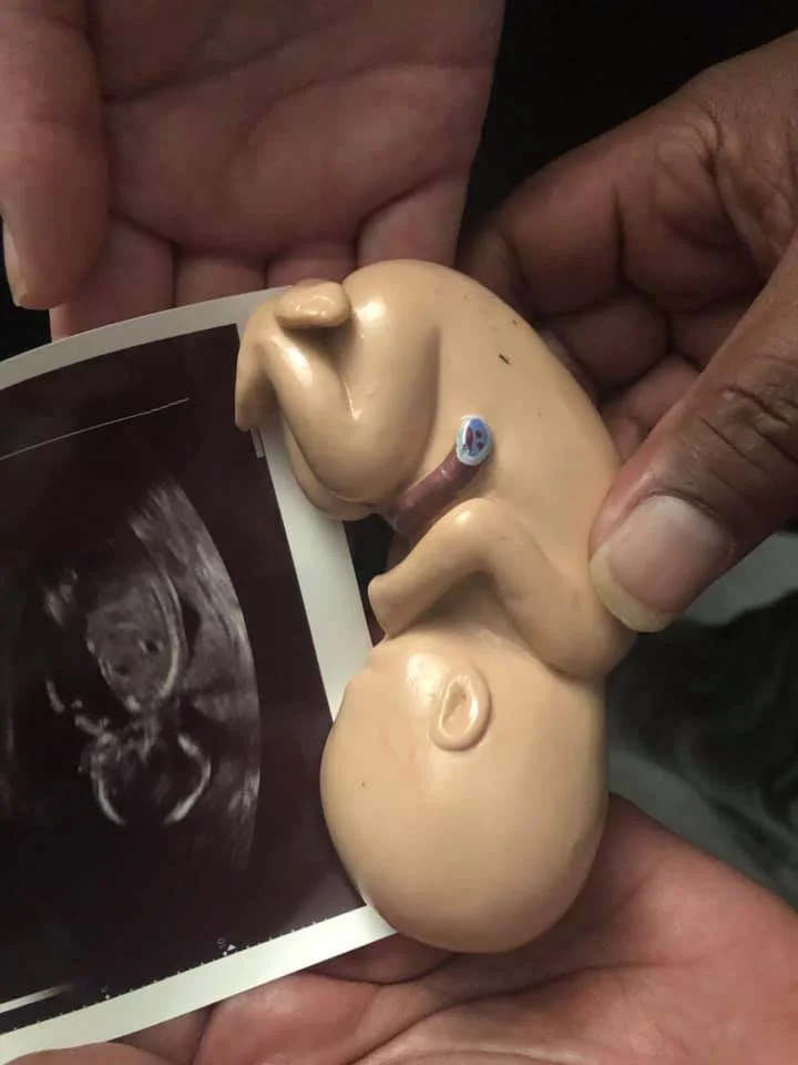 Hands holding a toy model of a pregnant woman with an ultrasound photo attached.