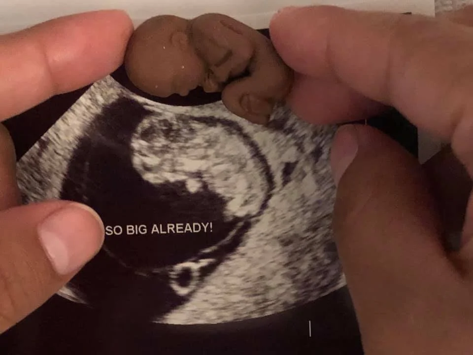 Person holding a ultrasound image of a developing fetus with a small 3D printed embryo model positioned near the top of the ultrasound image.