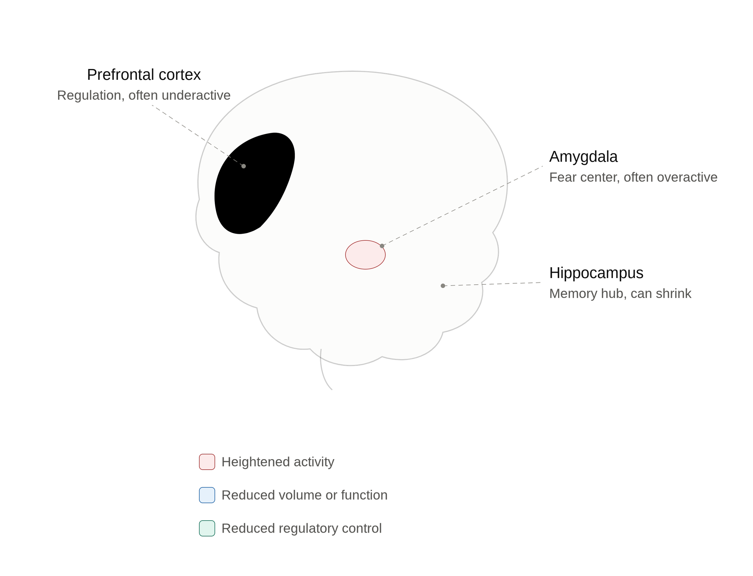    How Trauma Affects the Brain