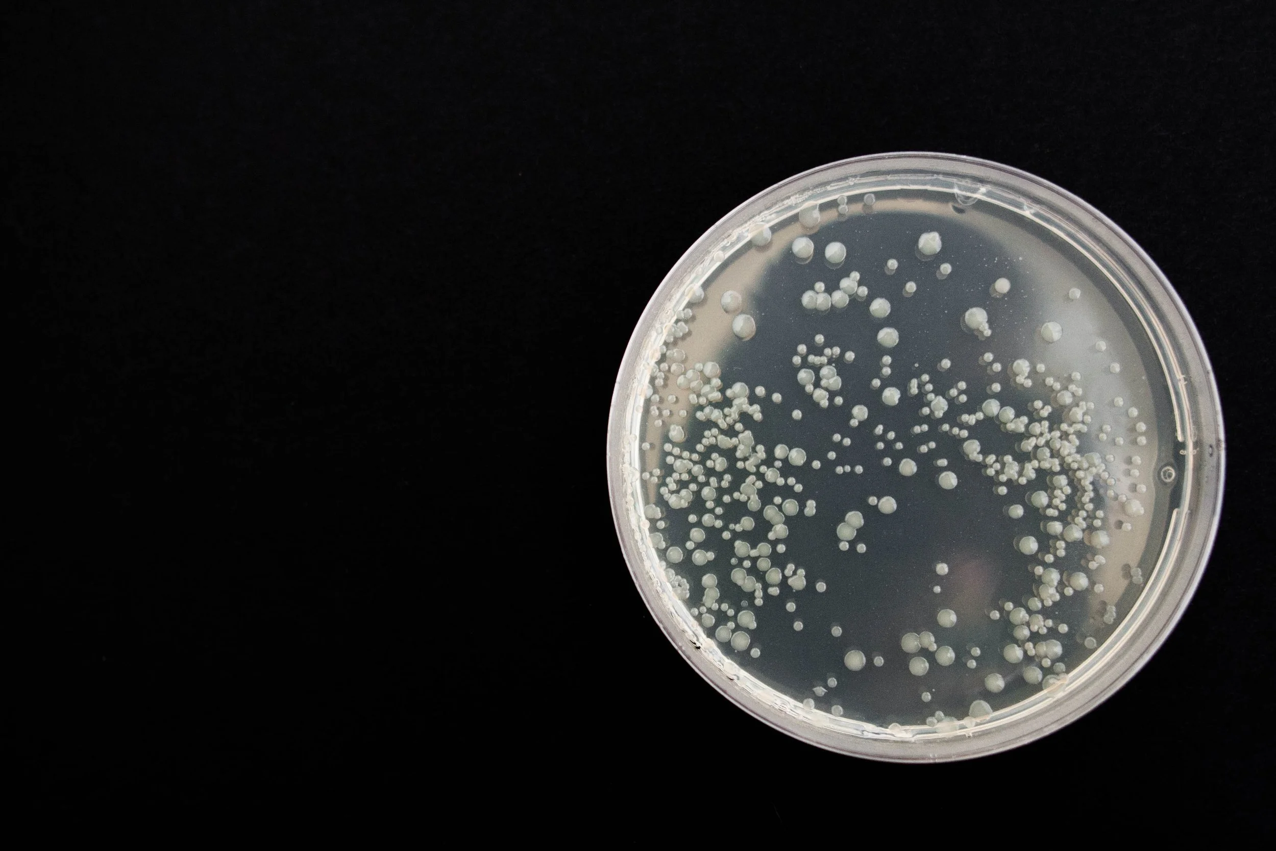 A petri dish filled with a clear liquid and numerous small white bacterial colonies growing on the surface.
