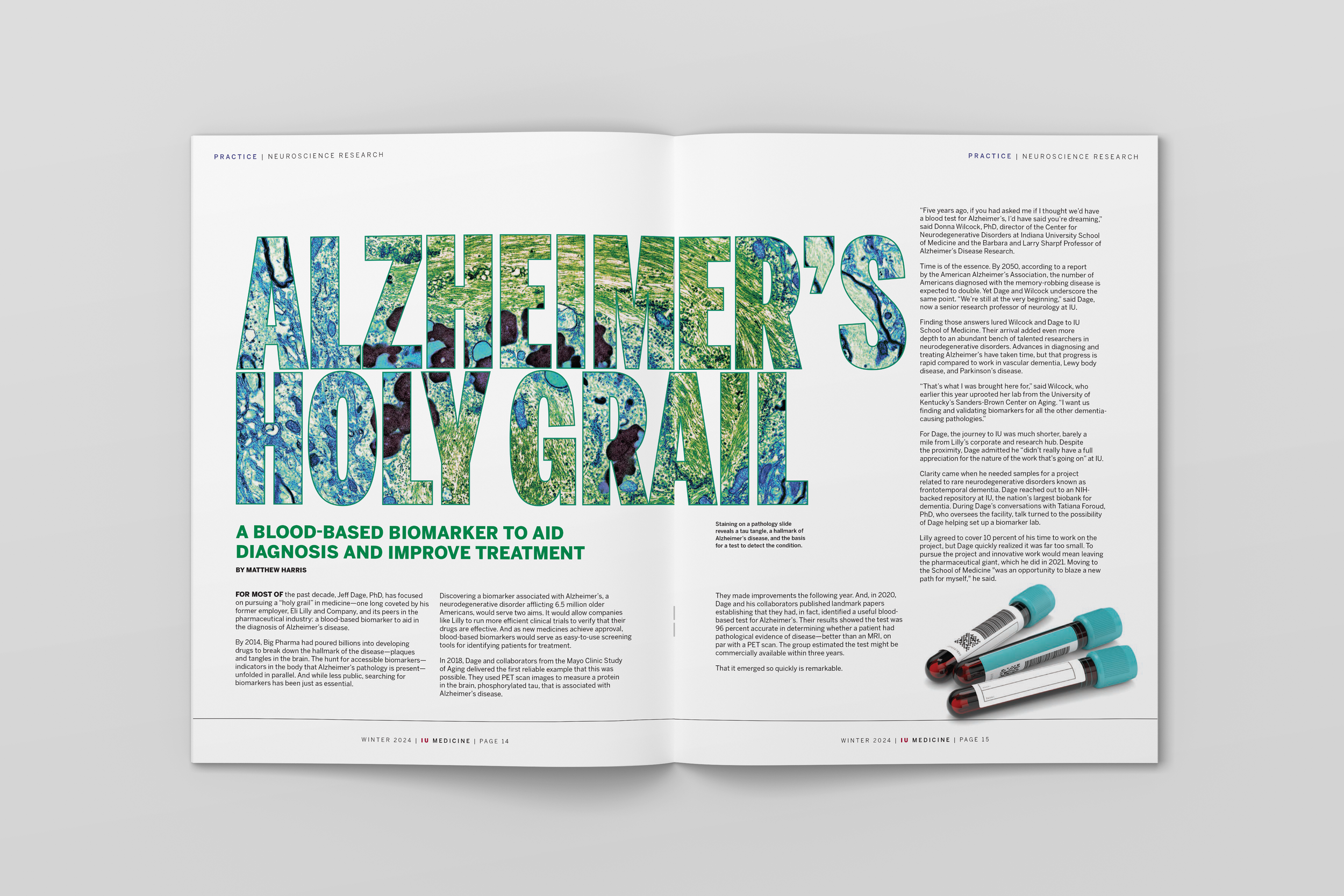 magazine spread with a headline "Alzheimer's Holy Grail"