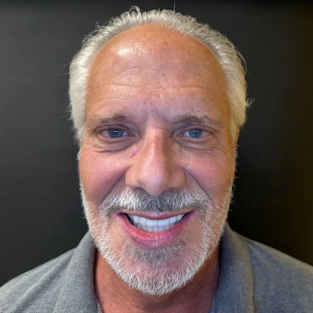 Smile Restoration