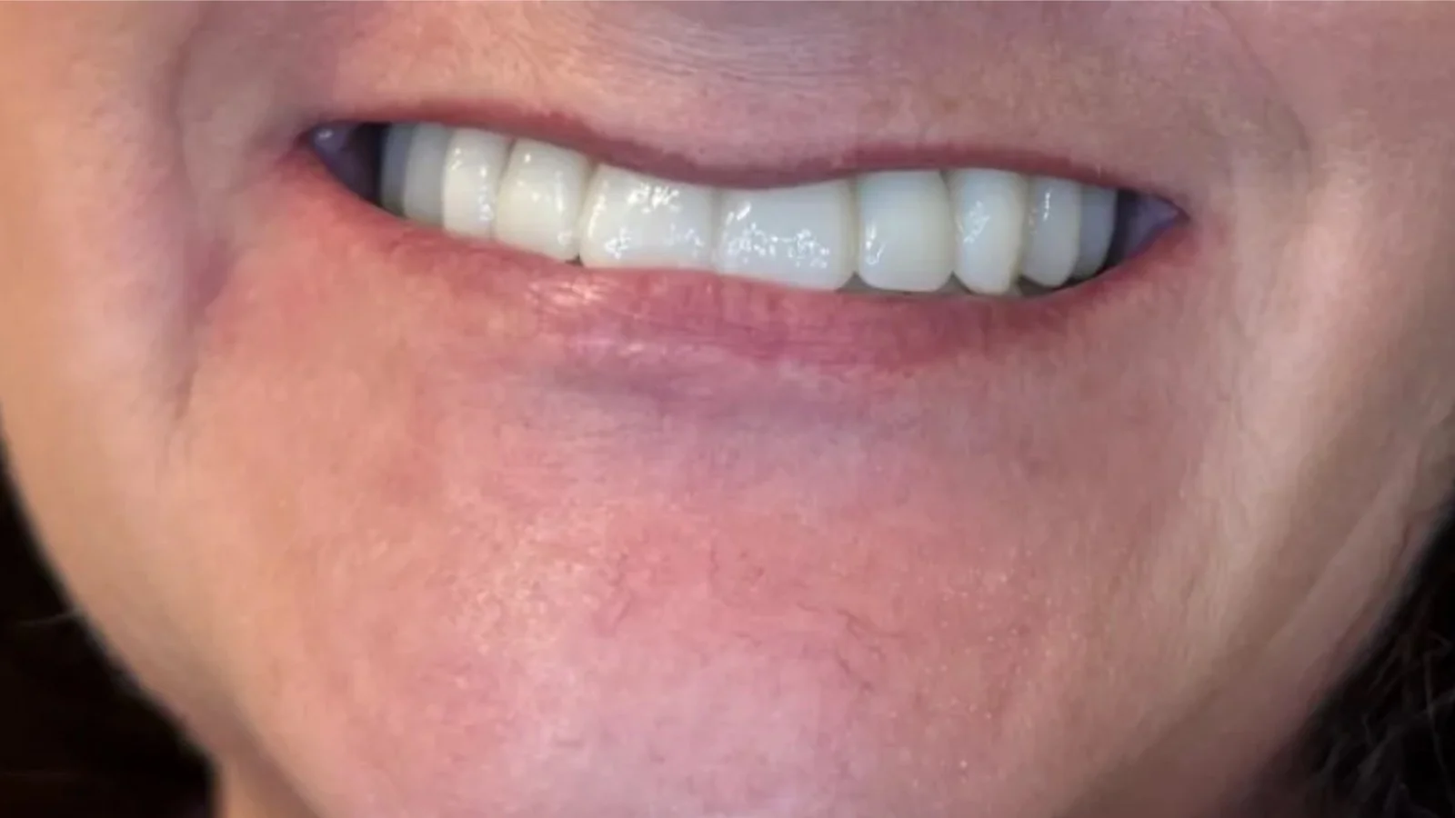 Close-up of a person's smile showing their white teeth and lips.