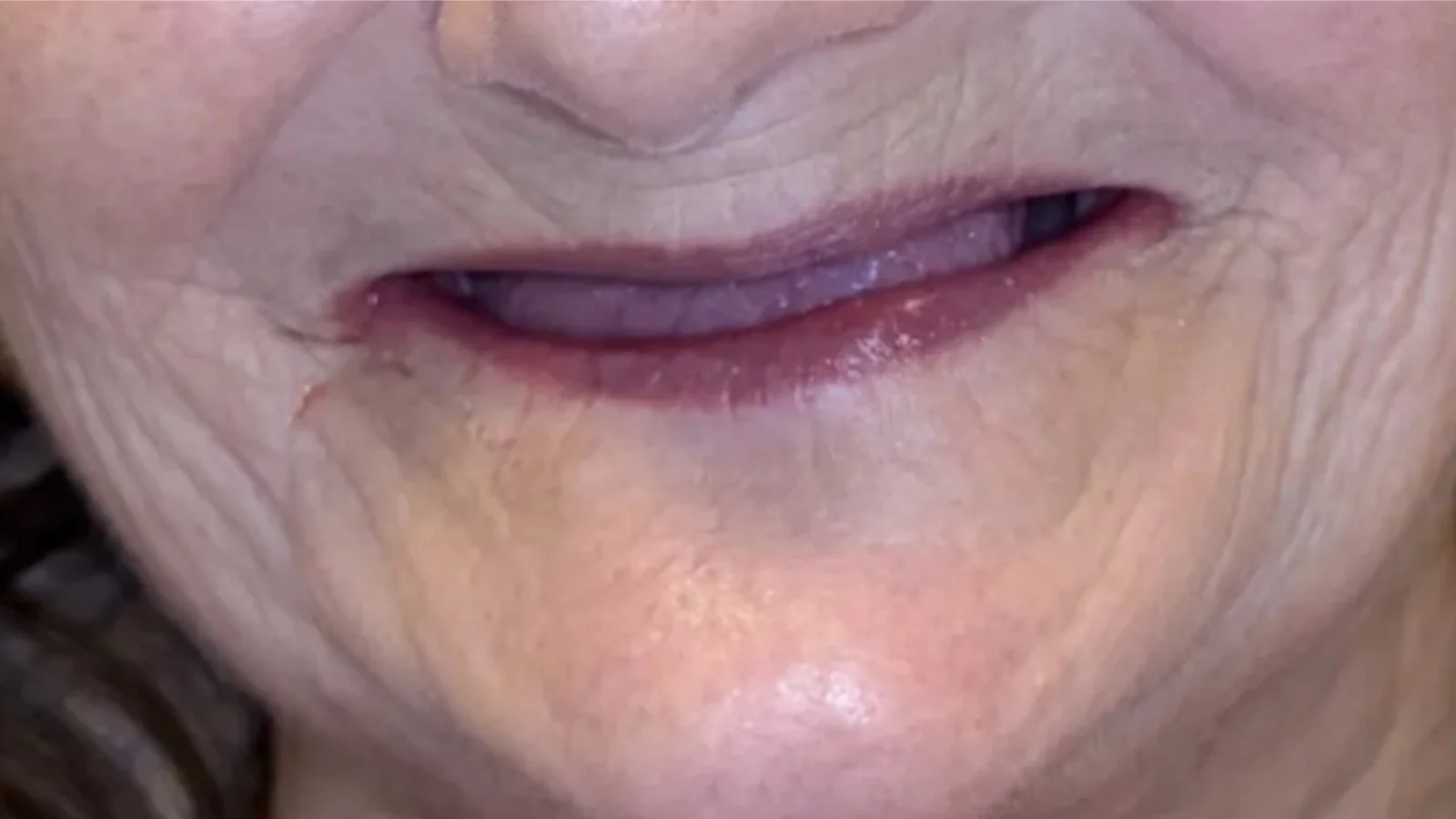 Close-up of an elderly woman's mouth and the lower part of her nose, showing wrinkles and thin lips.