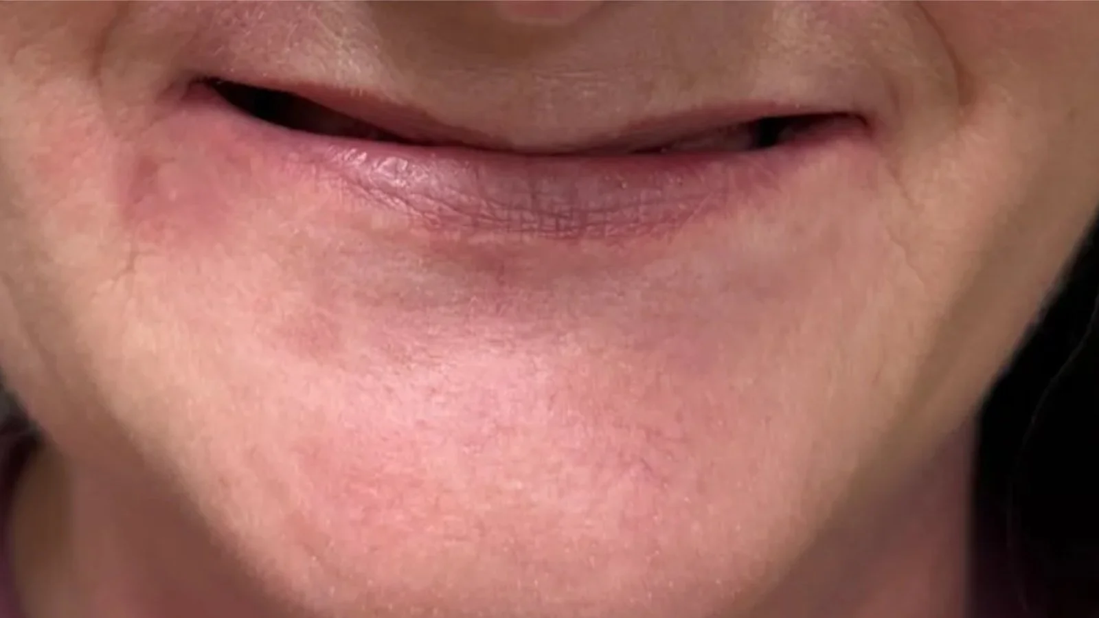 Close-up of a person's mouth smiling with visible lips and skin texture.
