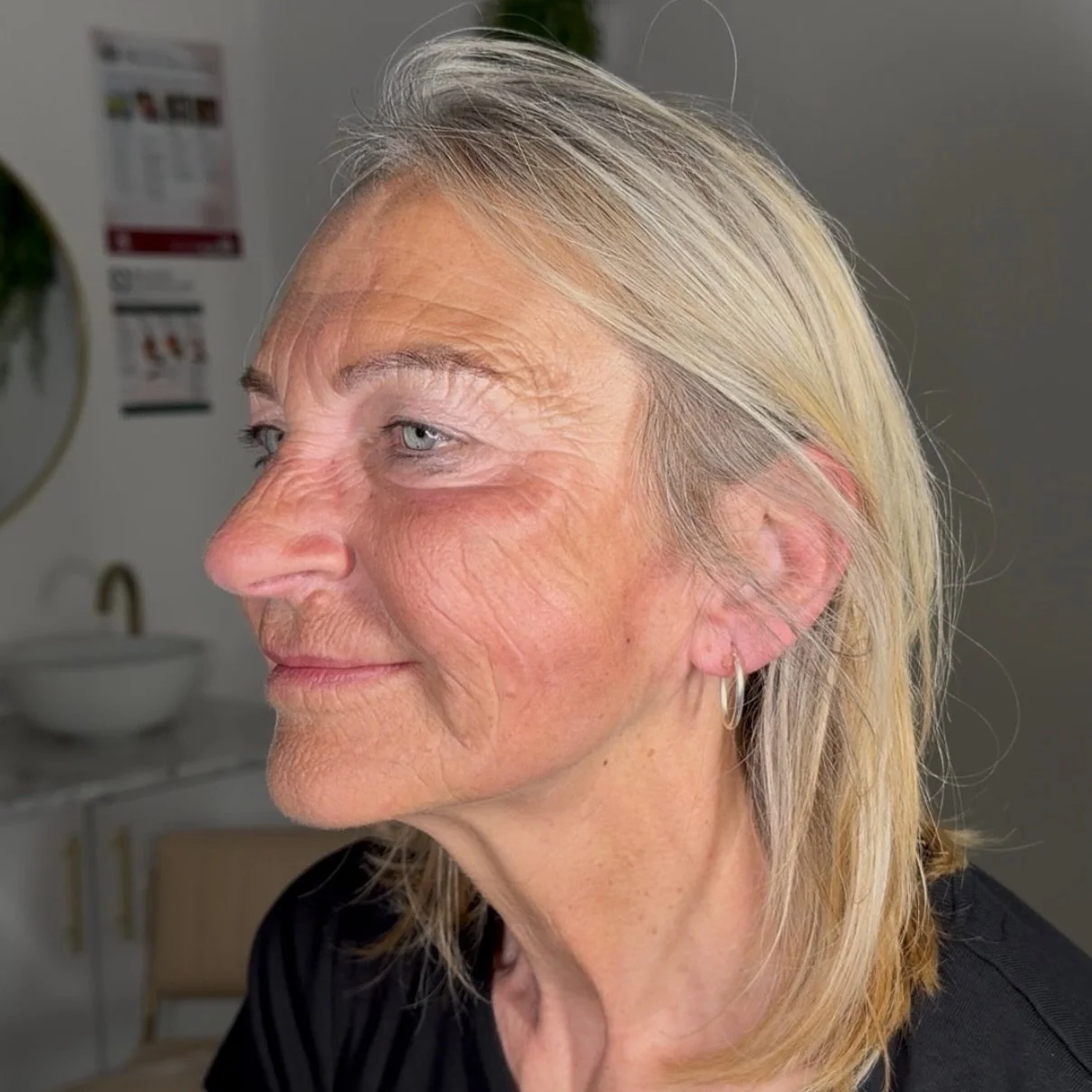ENDOPULSE LASER SKIN TIGHTENING

SEE SLIDE 5 FOR HALFWAY RESULTS ⏩️

Struggling with sagging skin, jowls or loss of definition around the jawline or crepey skin on your arms/stomach?

EndoPulse is an advanced, minimally invasive treatment designed to