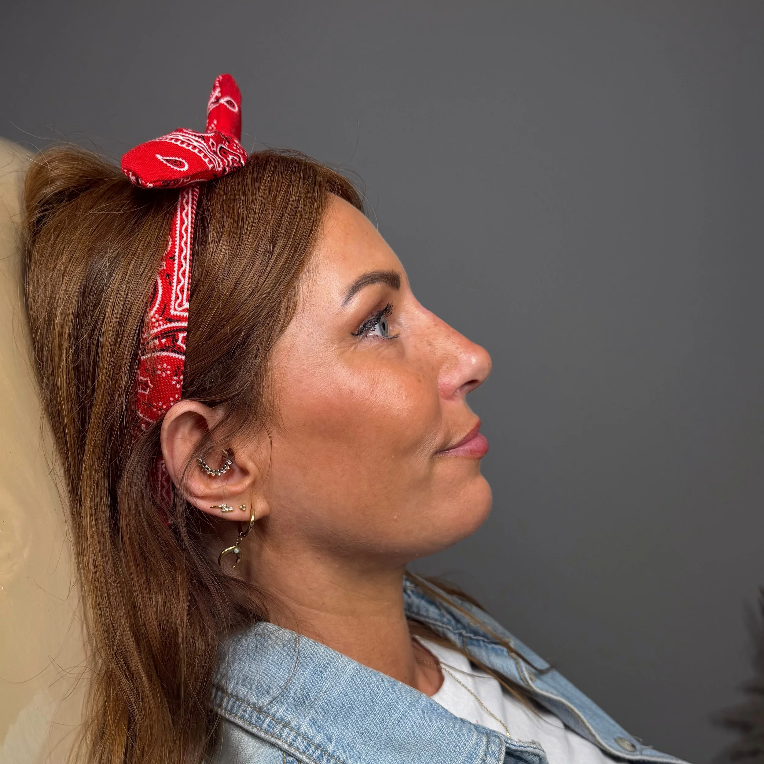 NON-SURGICAL RHINOPLASTY 

It&rsquo;s amazing how a small, precise tweak can completely elevate your profile.

If you&rsquo;re looking to refine your nose shape without surgery or downtime, our Non-Surgical Rhinoplasty is a fantastic option. Using pr