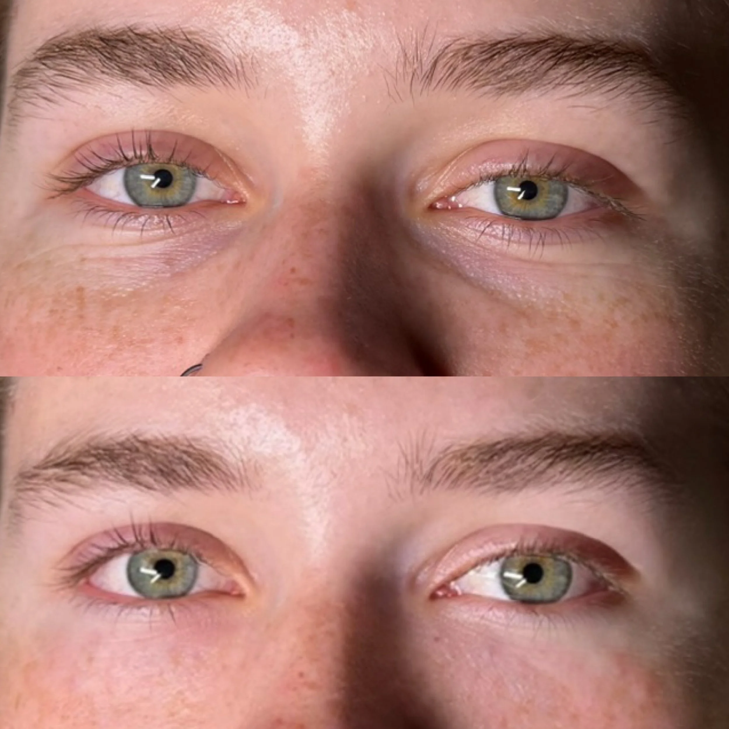 VITARAN EYES

SWIPE FOR MORE PHOTOS ⏩️

Vitaran Eyes is one of the most advanced treatments available for improving the appearance of tired, crepey and ageing under eye skin, but achieving great results isn&rsquo;t just about the product being used.
