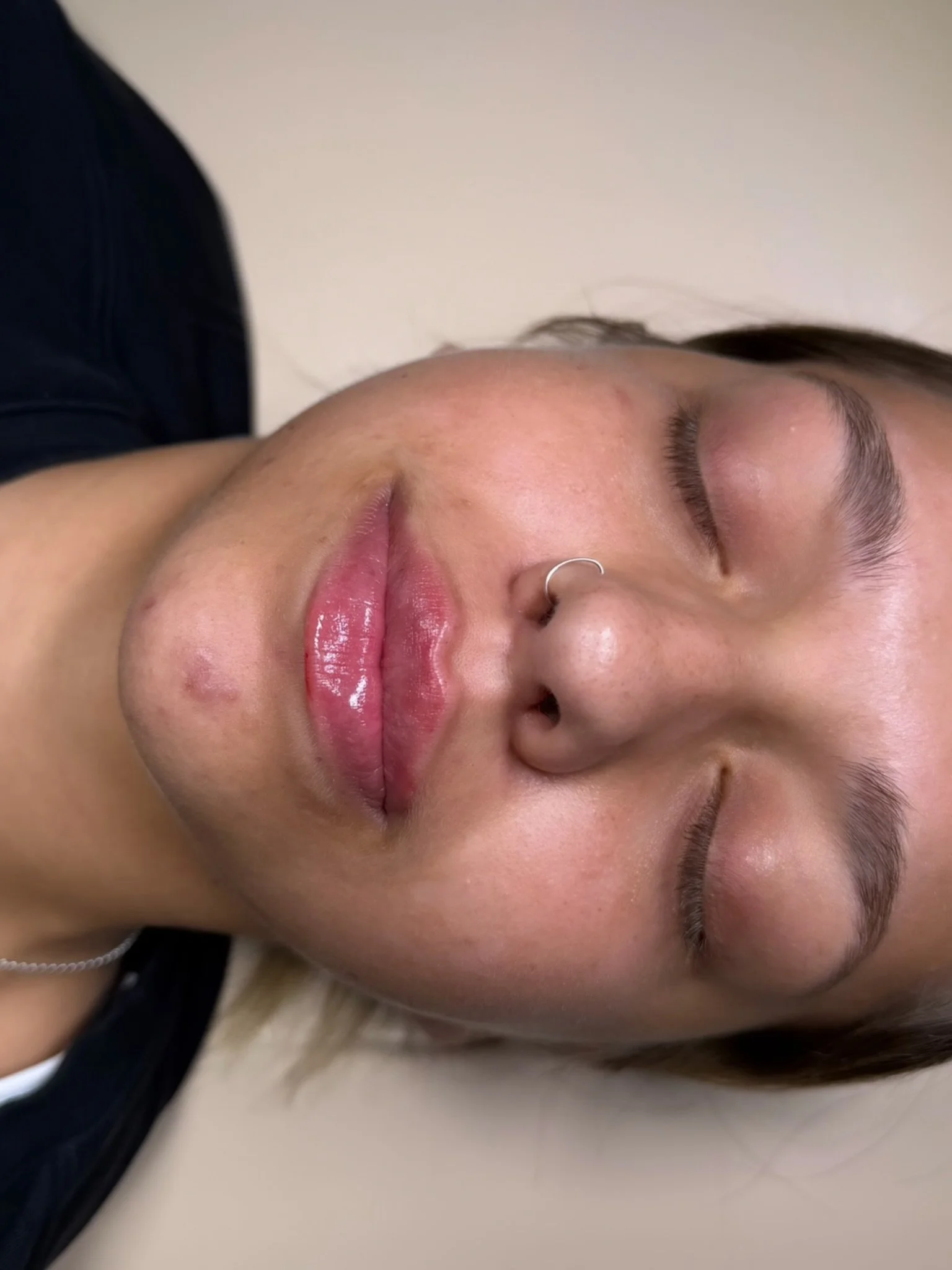 TRADITIONAL LIPS

SWIPE FOR BEFORE ⏩️

Subtle, soft, and oh-so-you.
Nothing overdone here, just natural volume with a defined, balanced shape.

Traditional lips are all about timeless elegance, gentle enhancement, and a finish that flatters your feat