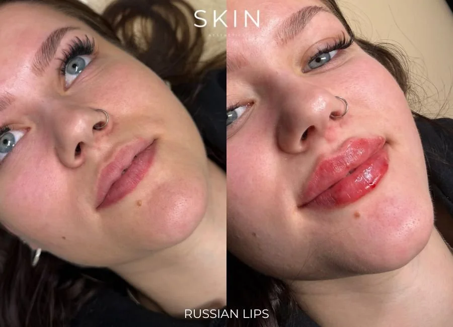 A side-by-side comparison photo of a woman before and after applying makeup to her lips. The left side shows her with natural lips, and the right side shows her with glossy, red lipstick labeled as 'Russian Lips.'
