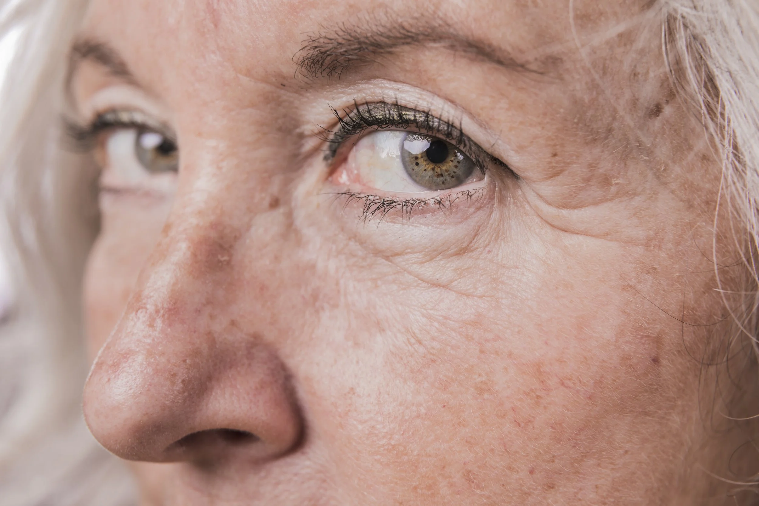 Understanding Pigmentation 
