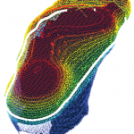 3D foot pressure map scancast showing high-pressure zones; gait analysis and custom orthotics by trusted chiropodist in St. Catharines at Canadian Foot Clinic & Orthotic Centre — biomechanical assessment, orthotic fitting.