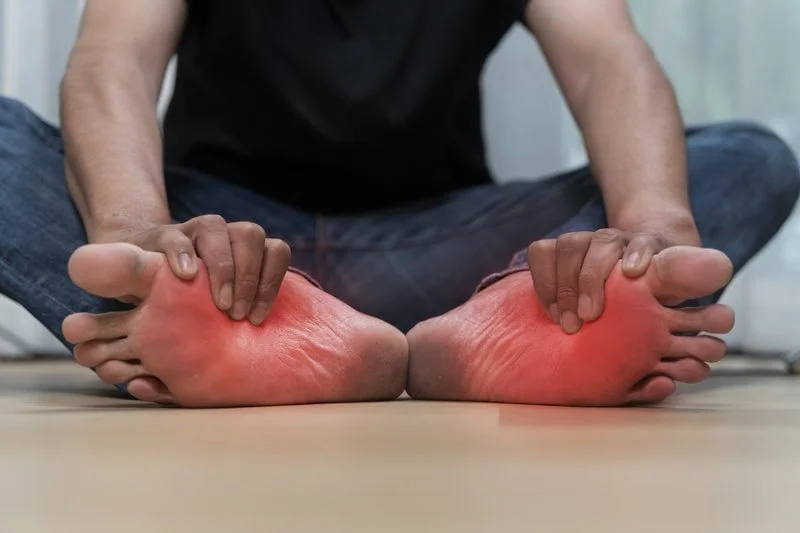 Plantar fibroma arch pain: palpable nodule causing sharp tenderness and altered gait; offloading, padding and custom orthotics by registered chiropodist Canadian Foot Clinic & Orthotic Centre, St. Catharines.