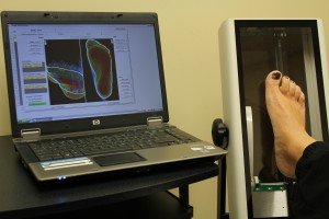 Scancast 3D laser foot scan for precision custom orthotics by a registered chiropodist at Canadian Foot Clinic & Orthotic Centre, St. Catharines — digital casting, gait analysis, custom orthotics, foot pain relief.