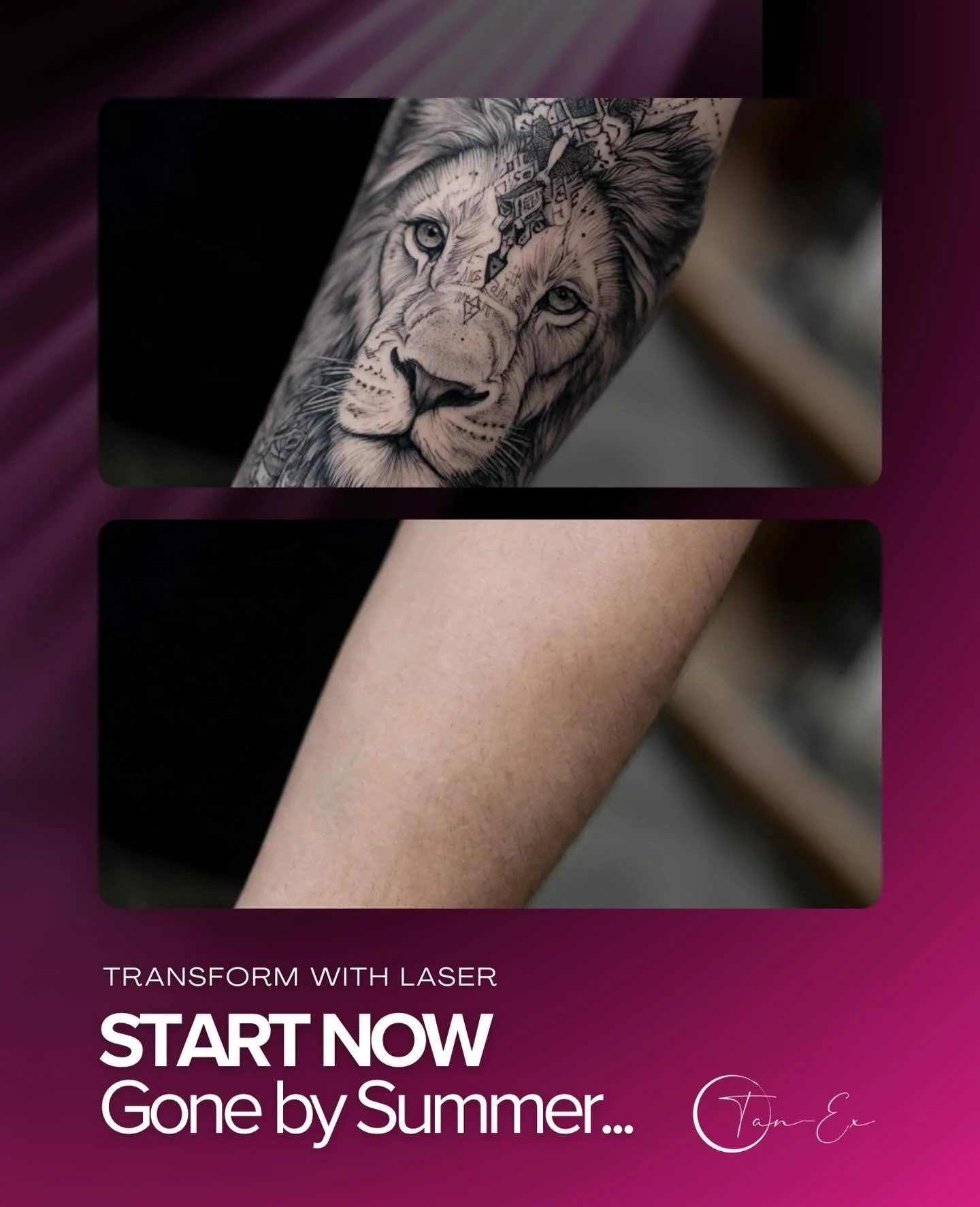 New year, new you&hellip; or new skin? 👀

Start tattoo removal this January and you could be tattoo free by summer.

📲 DM us to book your appointment or call us today to secure your spot!

#aestheticclinicmerthyr #lasertreatment #lasertattooremoval