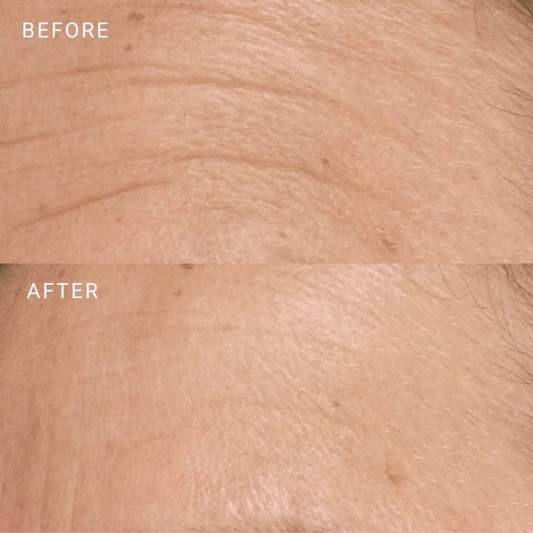 5-Before and After Bota.jpg