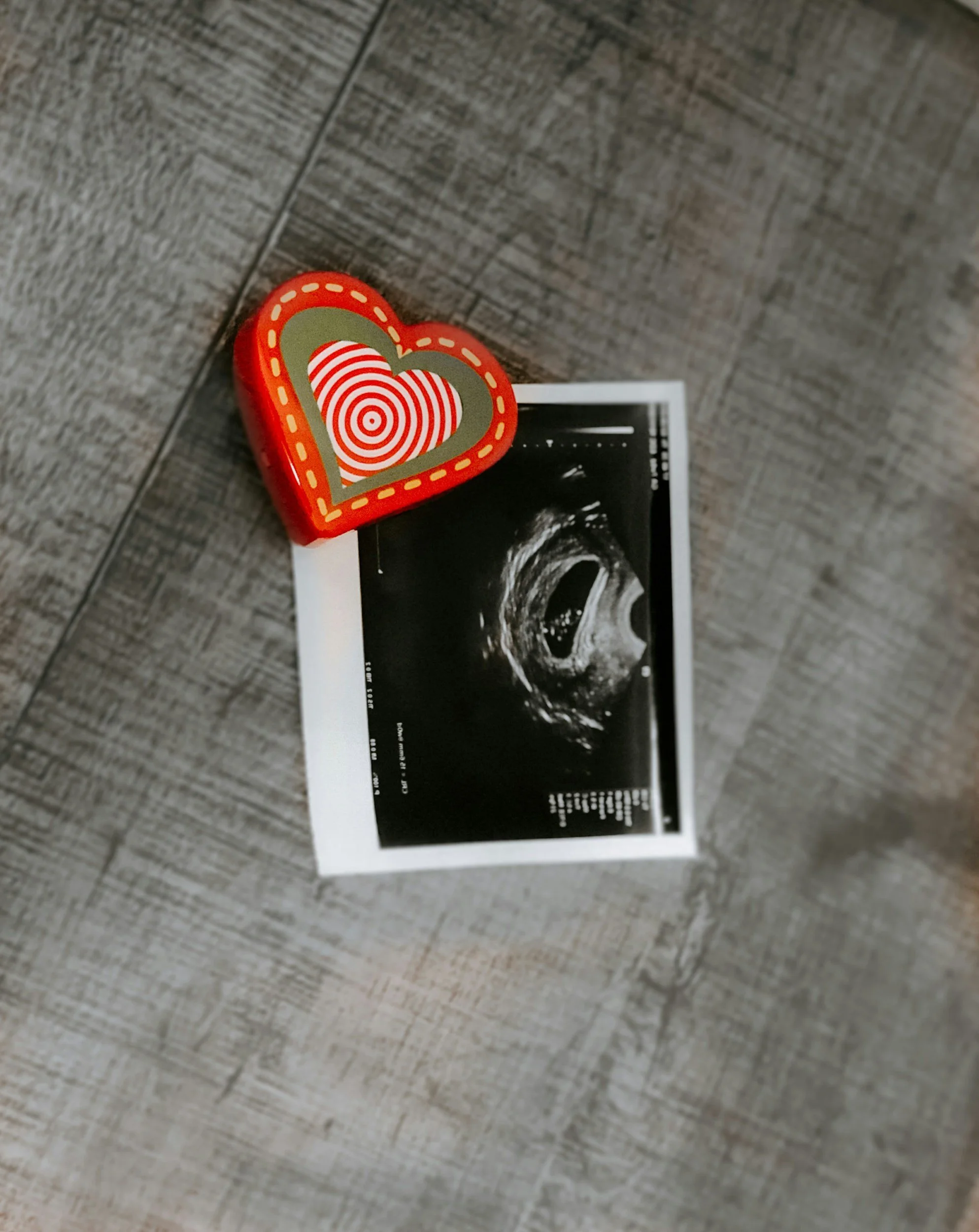 A black and white ultrasound printout on a wooden surface, partially covered by a red and white heart-shaped object.