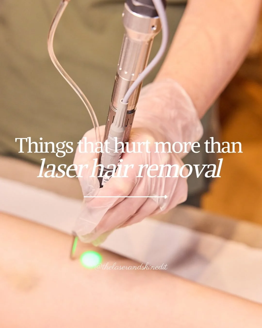 Things that hurt more than laser hair removal💅 

Yes, really. If you&rsquo;ve survived stepping on Lego, you&rsquo;ll survive laser☺️ 

Laser feels like a quick snap&hellip; not the dramatic pain it&rsquo;s made out to be. 

Less ouch, more why didn