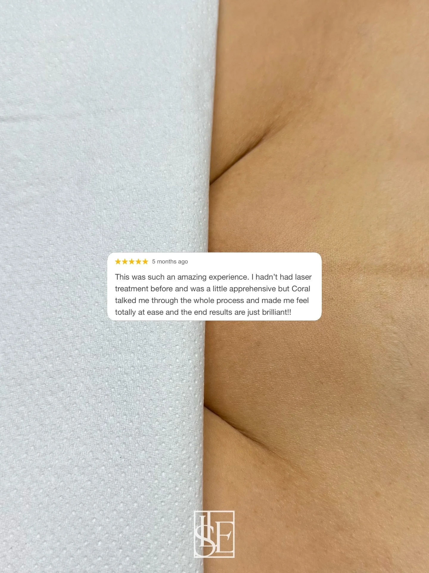 If you&rsquo;re dreaming of a stress-free summer &mdash; no irritation, no shaving rash, no ingrown hairs &mdash; it&rsquo;s not too late to start your laser journey ✨

Booking link is in our bio 🤍

#laserhairremoval #laserhairresults #laserclinic #