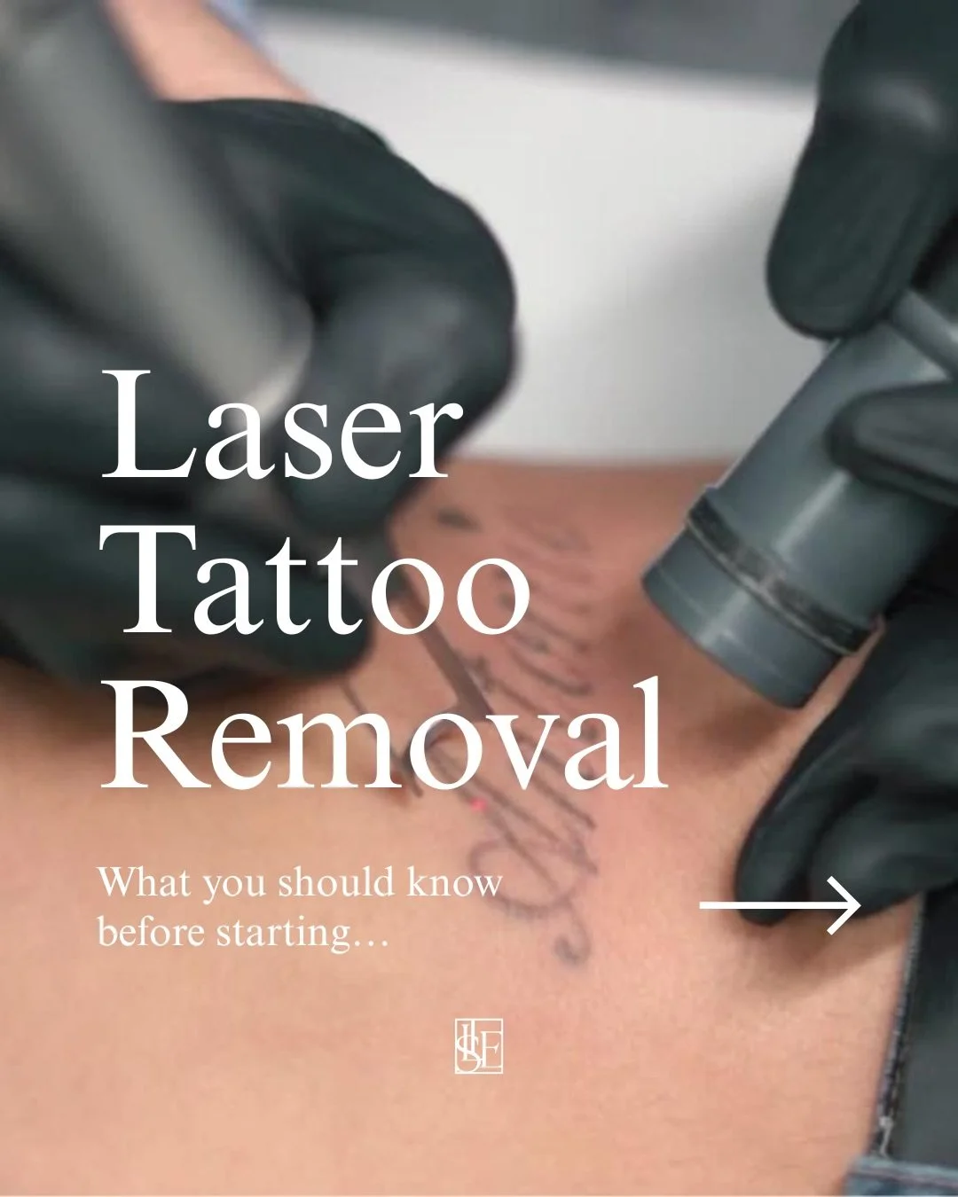 You asked, we delivered! ⚡️ Laser Tattoo Removal is officially coming to The Laser &amp; Skin Edit 👌

This has been one of the most requested treatments and after lots of planning and choosing the right technology, I&rsquo;m so excited to finally in