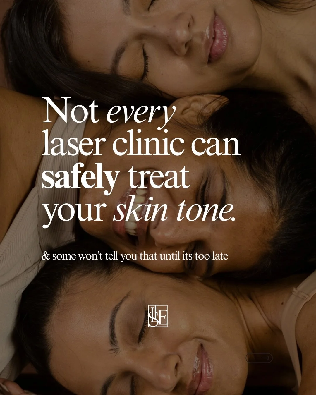 Can we talk about something the laser industry really doesn&rsquo;t shout about? 👀 
Not every clinic can safely treat every skin tone and a lot of people don&rsquo;t find that out until they&rsquo;re already 3/4 way into their course and their resul