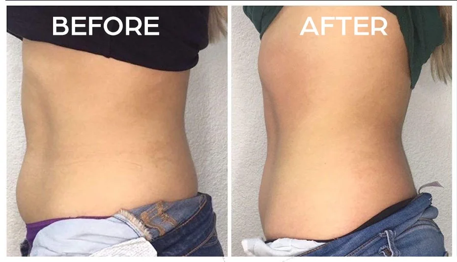 Side-by-side photos showing a woman's midsection before and after weight loss or body toning, with the word 'BEFORE' on the left and 'AFTER' on the right.