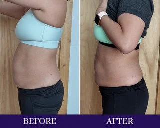 Side-by-side comparison of a woman's torso showing weight loss progress, labeled 'Before' and 'After'.