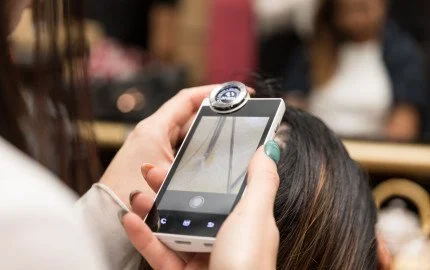 Professional Hair Microscope Diagnosis