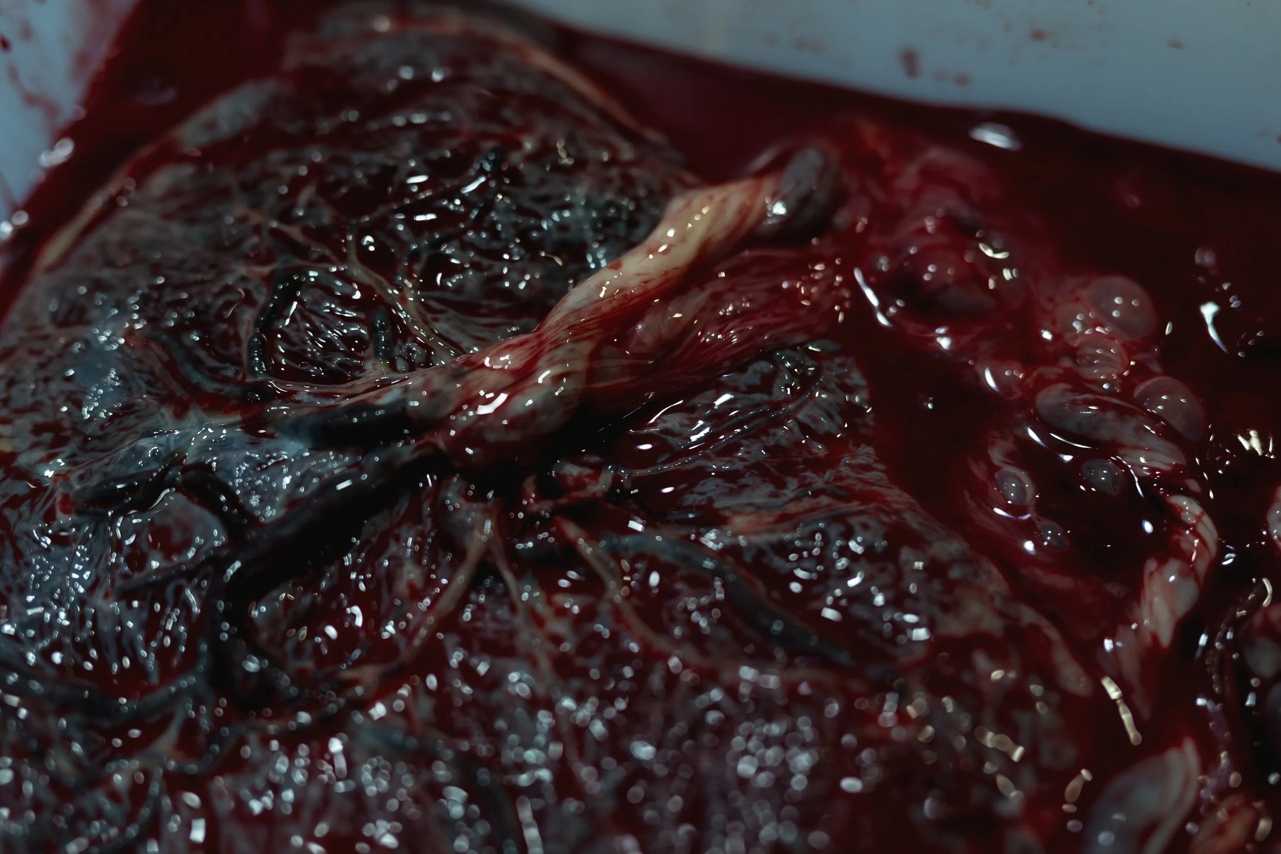 Afterbirth: Placenta Encapsulation