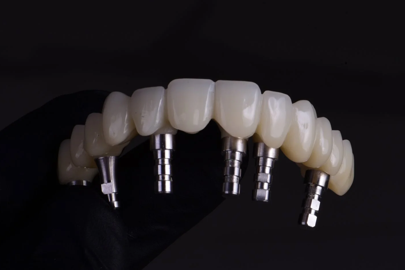 Modelo de dientes protesis fija con tornillos de metal en un fondo oscuro.