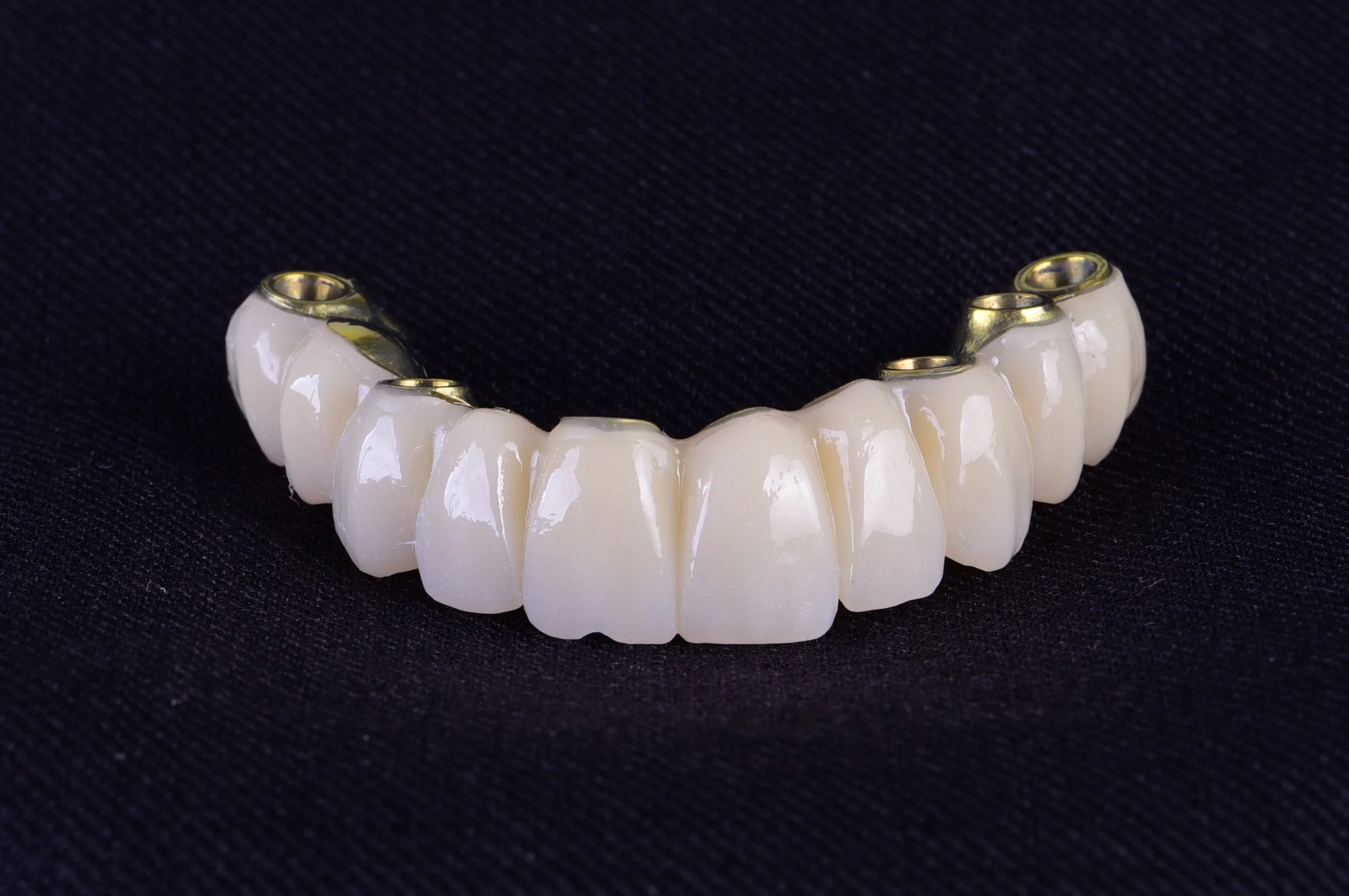 Prótesis dental de cerámica en forma de dientes humanos, con base metálica, sobre fondo negro.