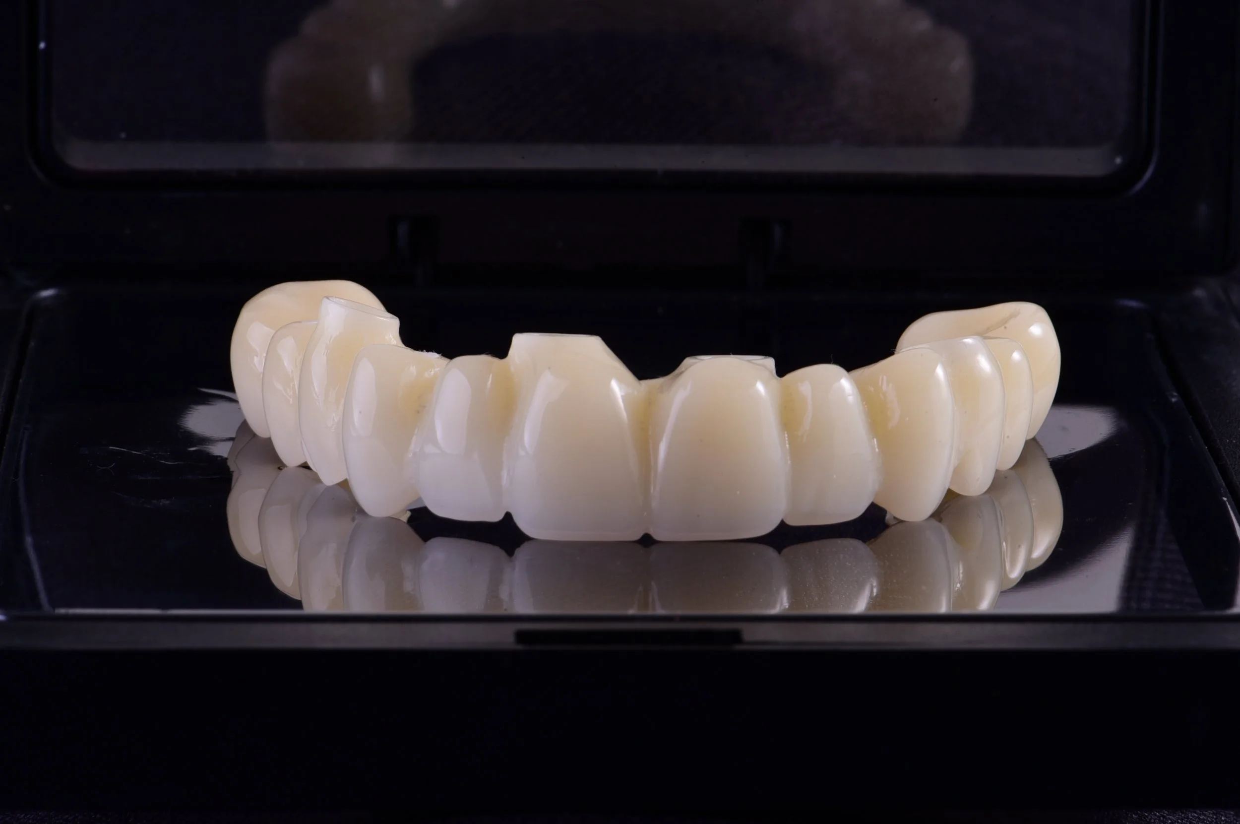 Corona dental de prótesis de dientes en color blanco colocada sobre una superficie negra que refleja la imagen.