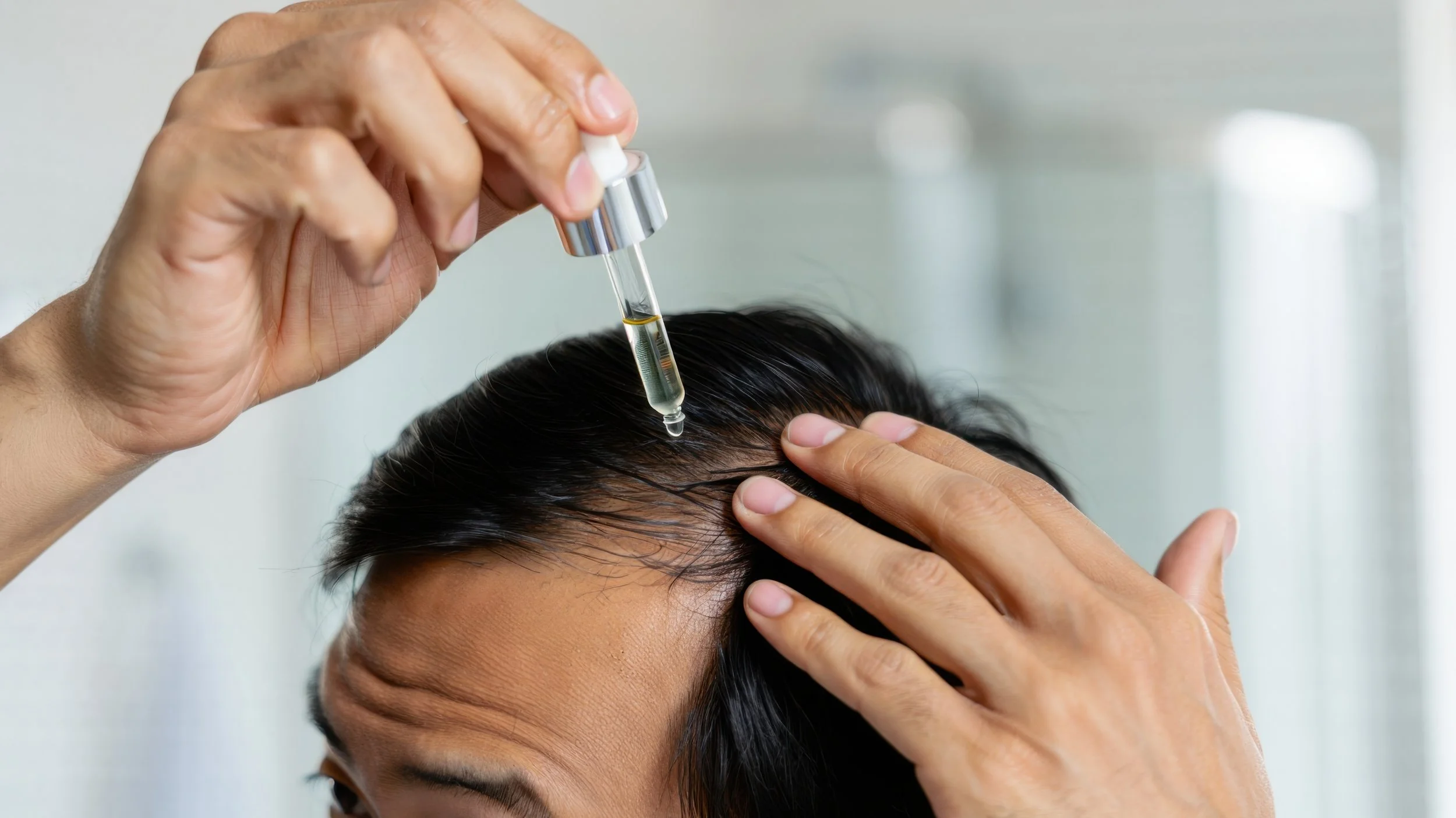 Anti Hair Loss Treatments